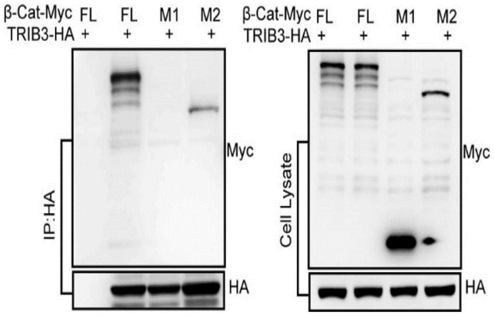 靶向抑制Wnt/β-catenin信号活性的多肽及其用途的制作方法