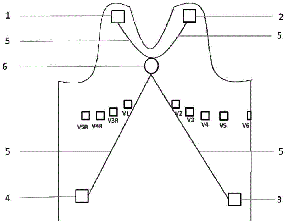 可穿戴电子服装的心电信号采集电极、装置及监测系统的制作方法