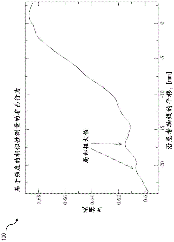 确定与医学图像的位移的系统的制作方法