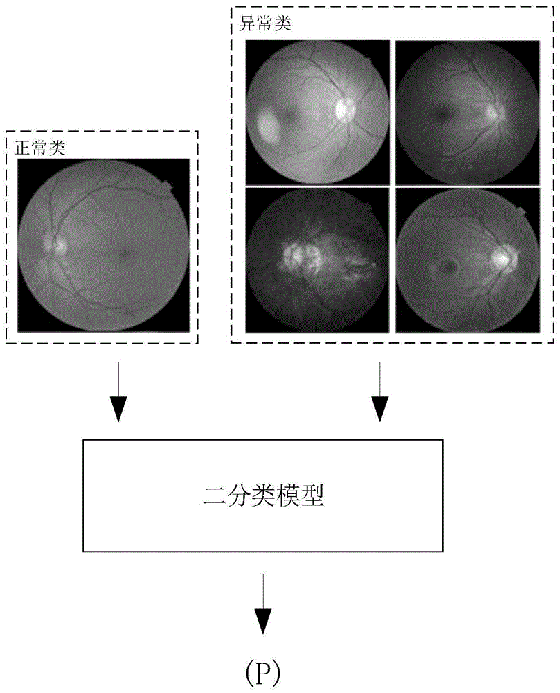 豹纹状眼底图像识别方法、模型训练方法及设备与流程