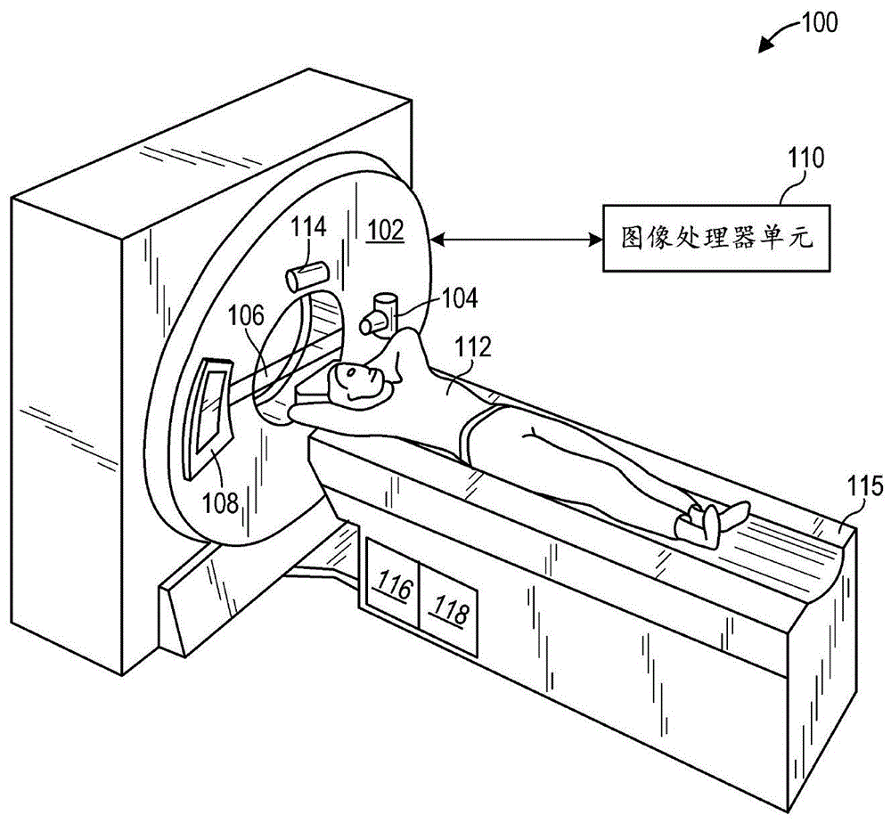 用于患者扫描设置的方法和系统与流程