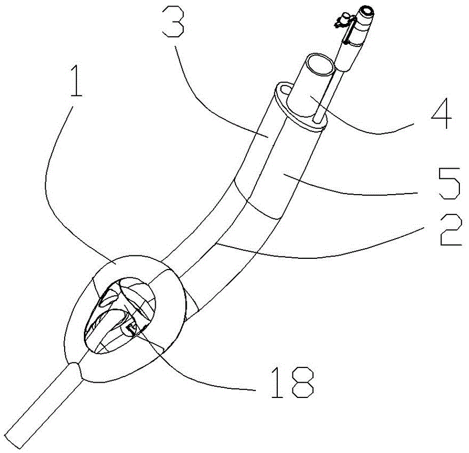 优选,喉管包括喉管主体以及连接在套囊一端于喉管主体相套接的套接部