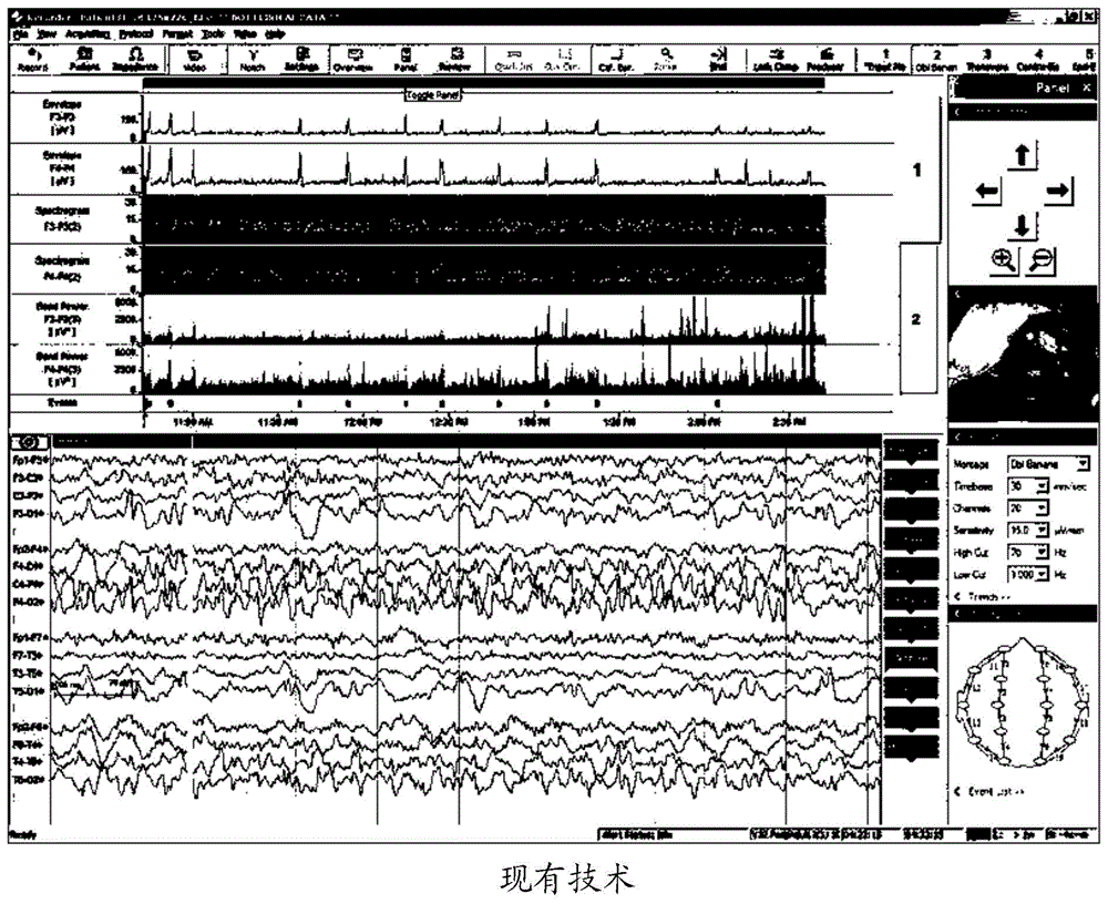 一种脑电图时频信息可视化方法与流程