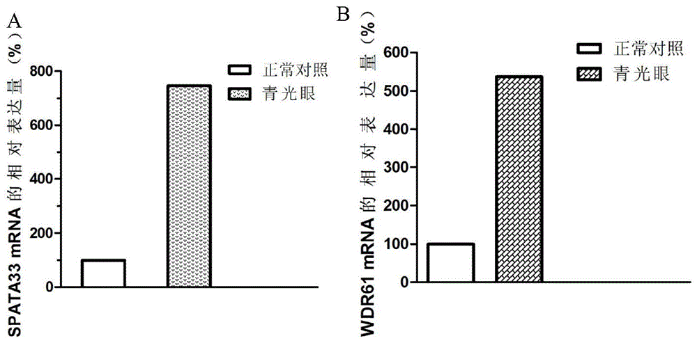 与青光眼发生发展相关的生物标志物及其应用的制作方法