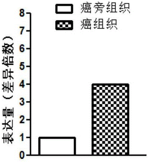 LOC100507599作为喉鳞癌诊断的分子标记的制作方法