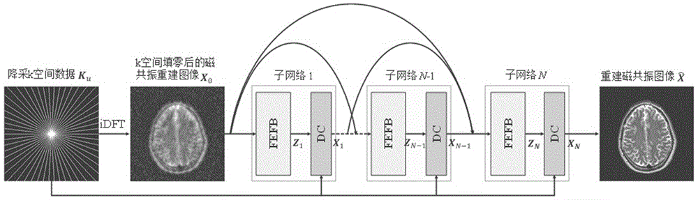 一种基于超深稠密网络的压缩感知磁共振图像重建方法与流程