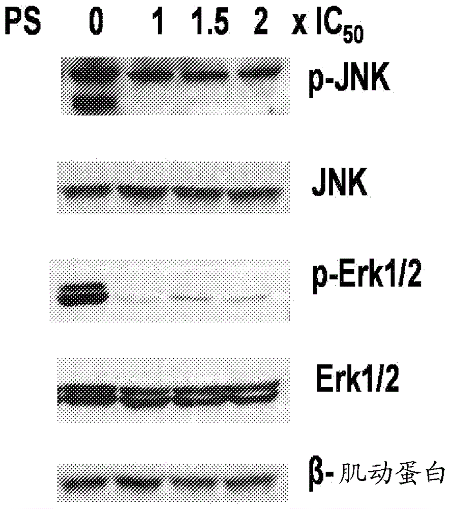 用于治疗眼科病况的组合物和方法与流程