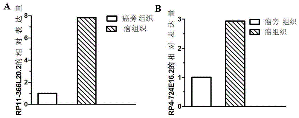 胃腺癌分子标志物及其应用的制作方法