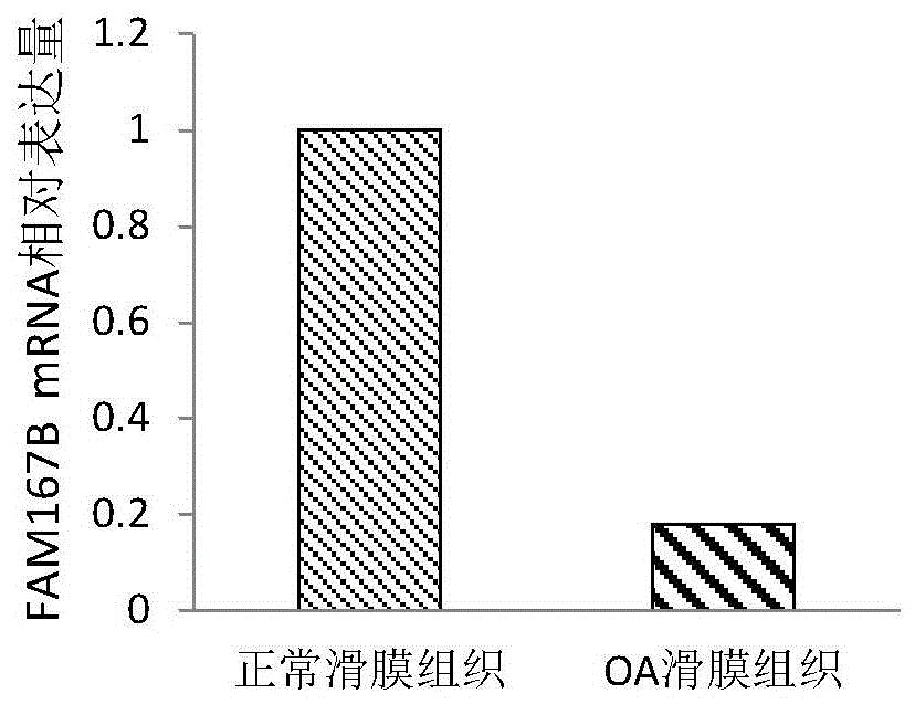 用于骨关节炎的诊断性分子标志物的制作方法