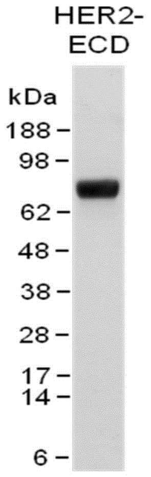 抗HER2抗体及其缀合物的制作方法