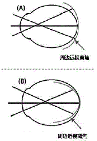 一种防治近视的眼镜镜片的制作方法