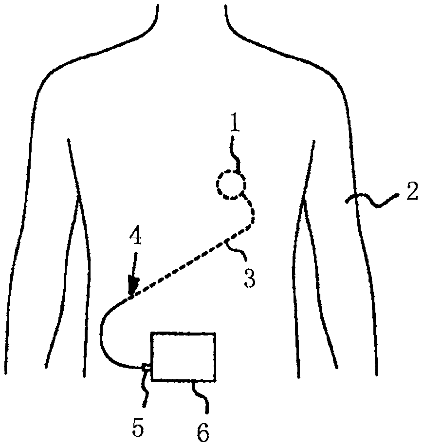 心脏泵装置和心脏泵装置的操作方法与流程