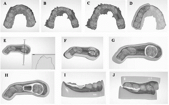 一种数字化间隙保持器的制作方法及其佩戴方法与流程