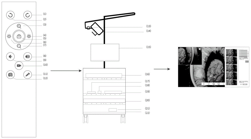 一种外科手术记录的遥控系统的制作方法