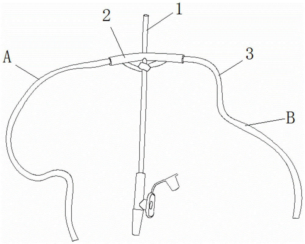 经鼻导管固定装置的制作方法