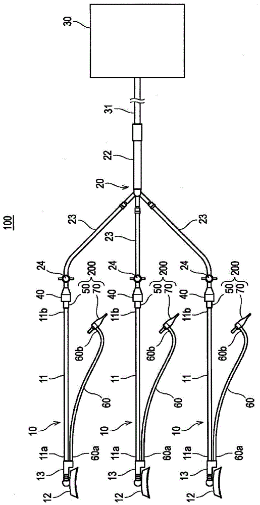 冠状动脉搭桥手术用处置器具、处置器具用零件、医疗用连接器及医疗器械的制作方法