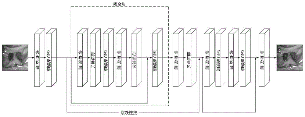 一种基于残差转置去卷积神经网络的胆道镜图像增强方法与流程