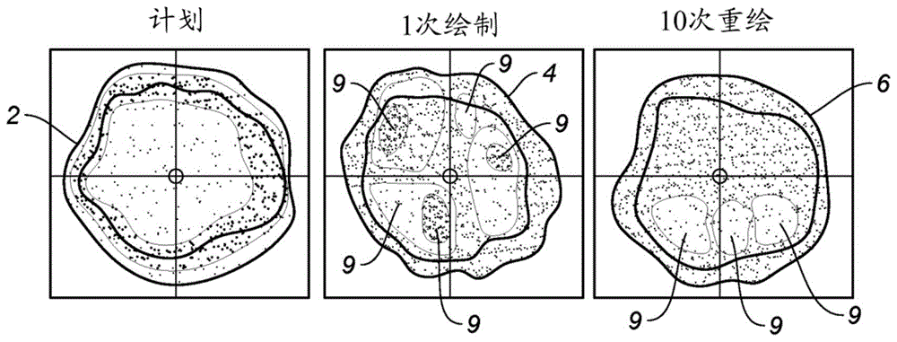 减轻粒子放射治疗中的相互作用效应的制作方法