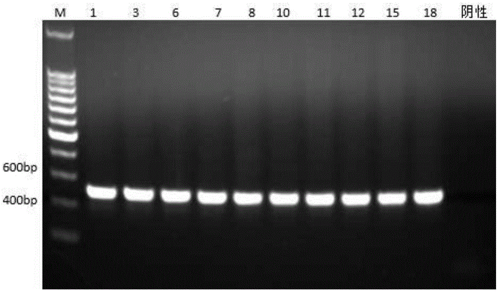 一种裸花紫珠DNA条形码标准检测序列及其应用的制作方法
