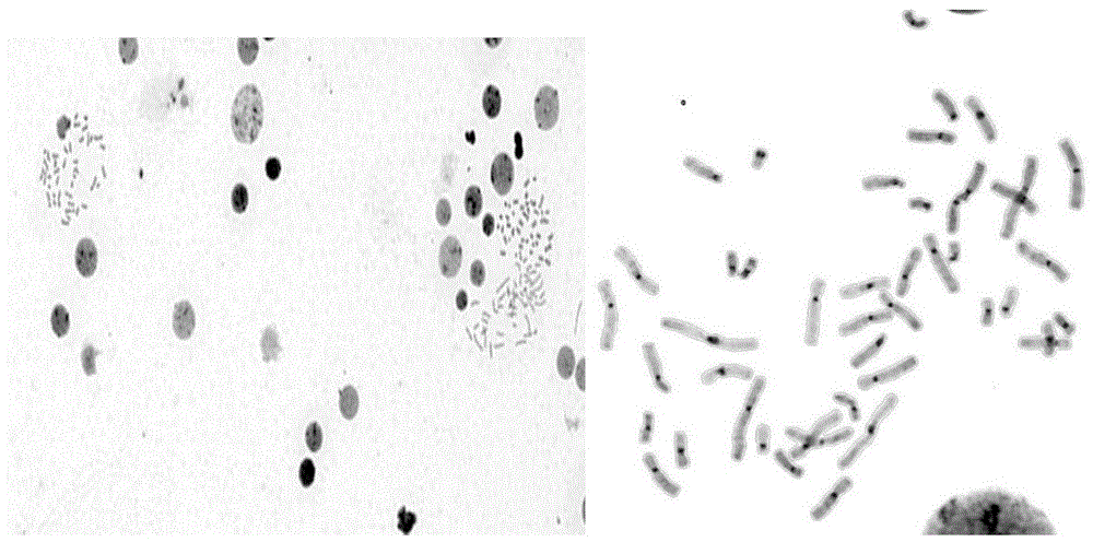 染色体c显带方法与流程