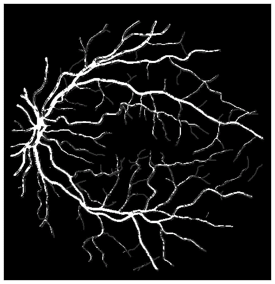 一种U-Net与自适应PCNN相结合的视网膜血管分割方法与流程