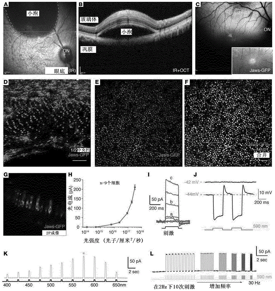 包括视网膜下递送治疗有效量的重组AAV9衍生载体的在对象的视锥细胞光感受器中表达目的多核苷酸的方法与流程