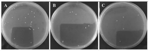 一种万古霉素修饰的黑磷量子点抗菌剂、制备方法及应用与流程