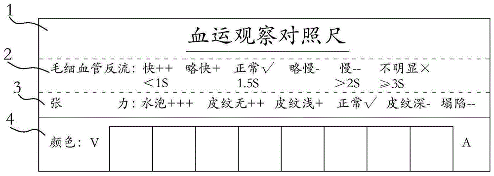 一种断指再植及游离皮瓣术后血运观察对照尺的制作方法