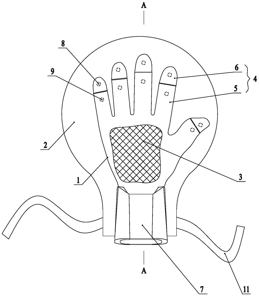 改良型五指分开式约束手套的制作方法