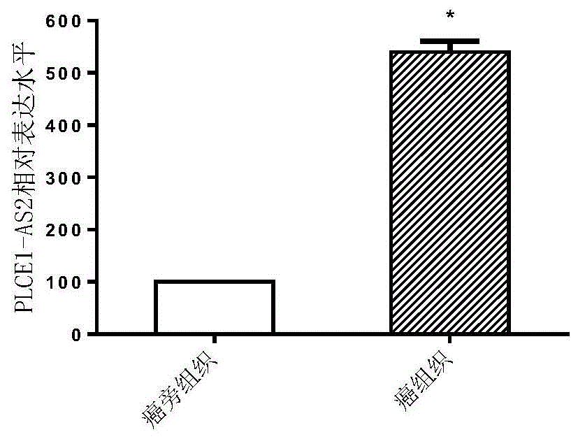 PLCE1-AS2在乳腺癌中的应用的制作方法