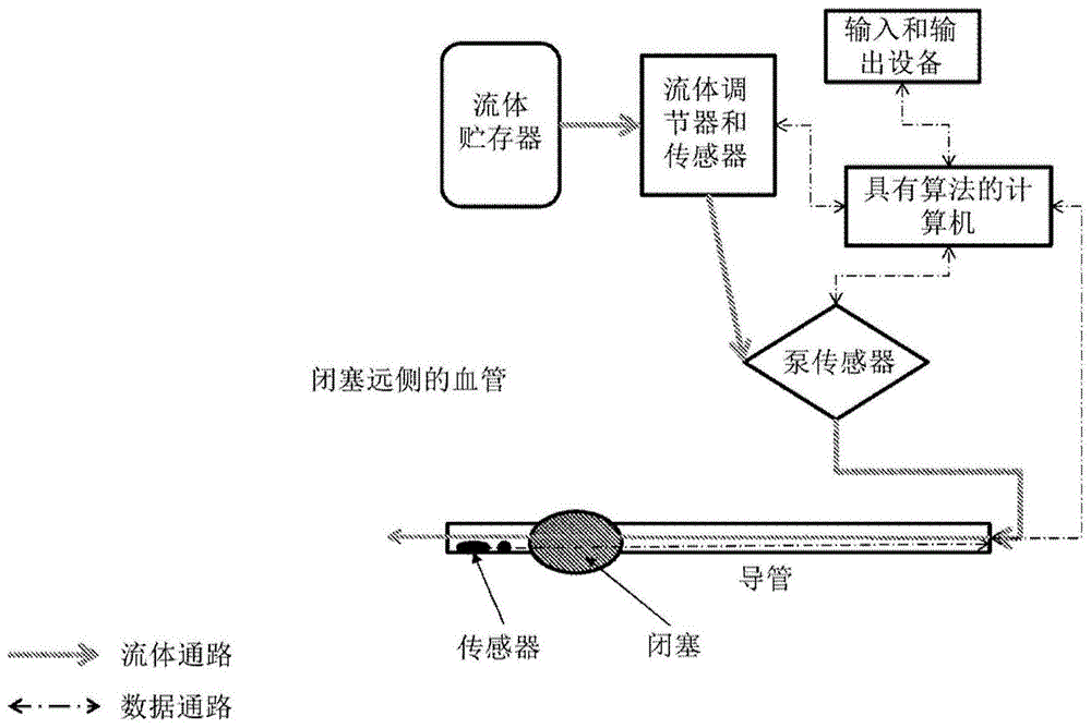 用于在动脉闭塞远侧灌注组织的系统和方法与流程