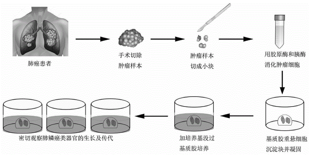 一种培养专用于生物医药功能研究的人肺癌类器官3D模型的方法与流程