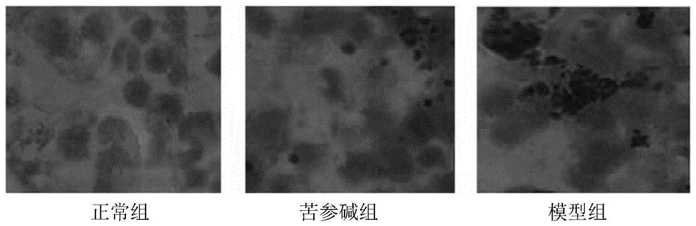 喹诺里西啶类Cu+和或Fe2+螯合剂及其药用盐的用途的制作方法