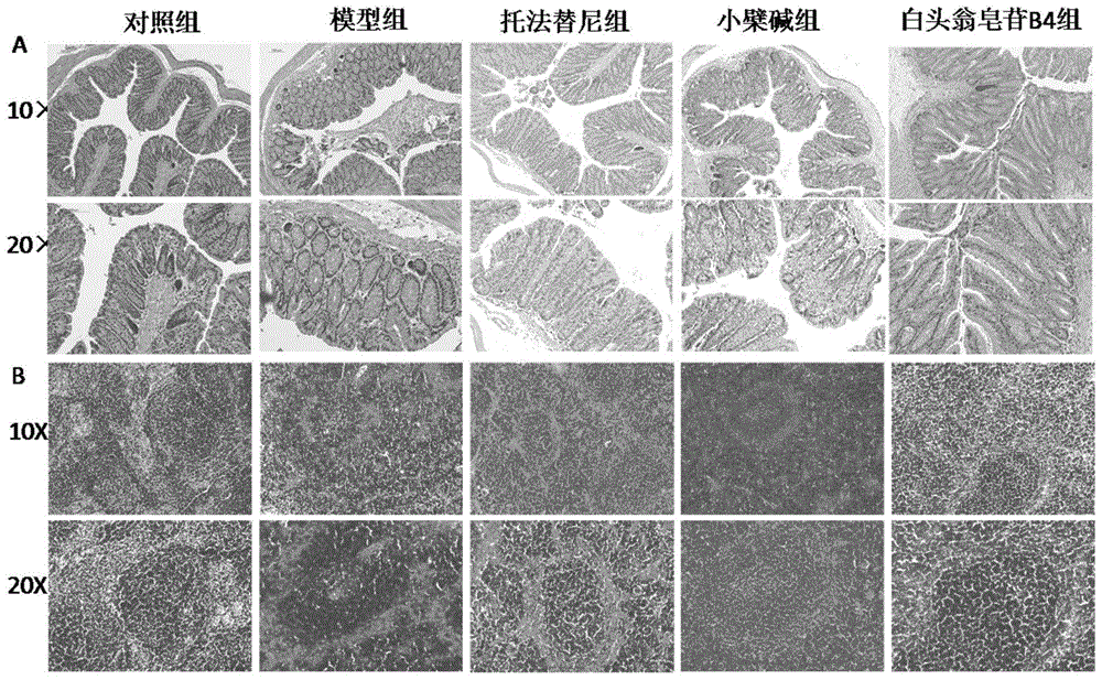 白头翁皂苷B4在制备治疗溃疡性结肠炎药物中的应用的制作方法