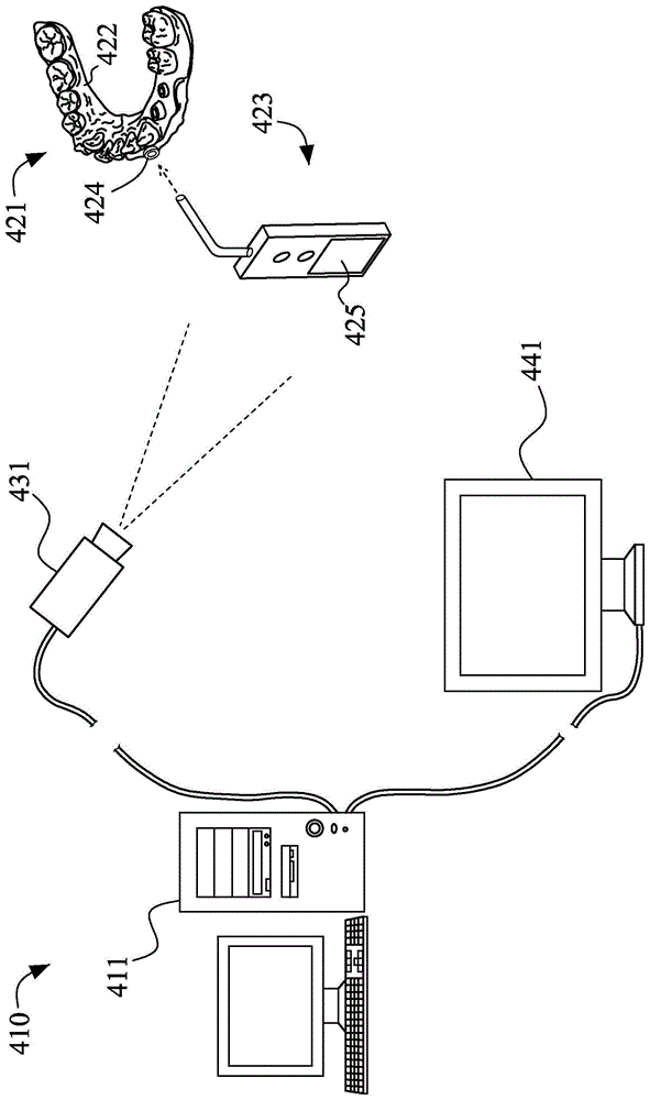 兼具光学导航功能的数字化种植导板及其使用方法与流程