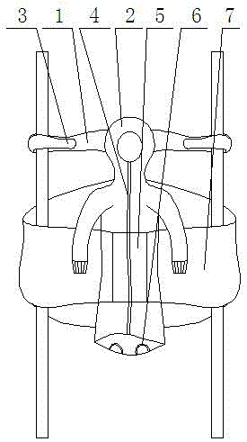 幼儿局麻手术衣的制作方法