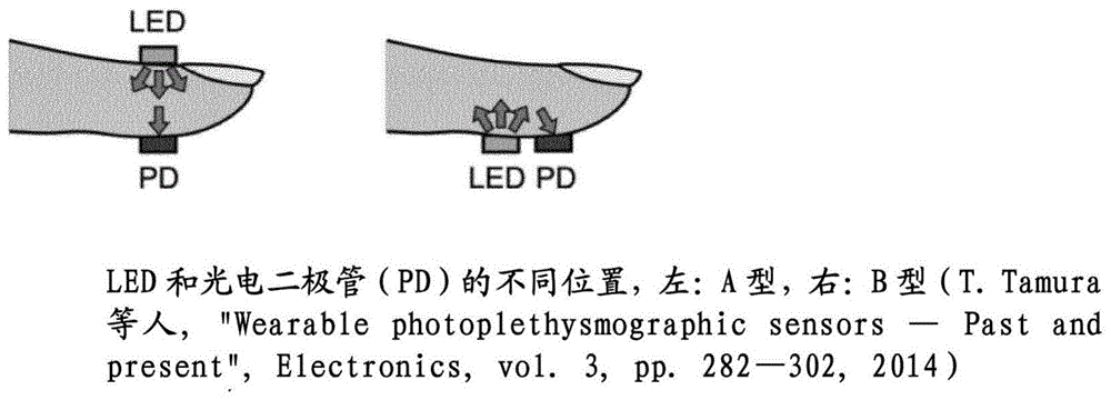 基于光电体积描记（PPG）信号估计血压和动脉硬化度的方法与流程