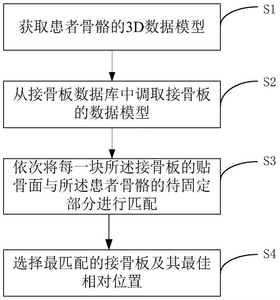 一种医用接骨板的匹配方法与流程