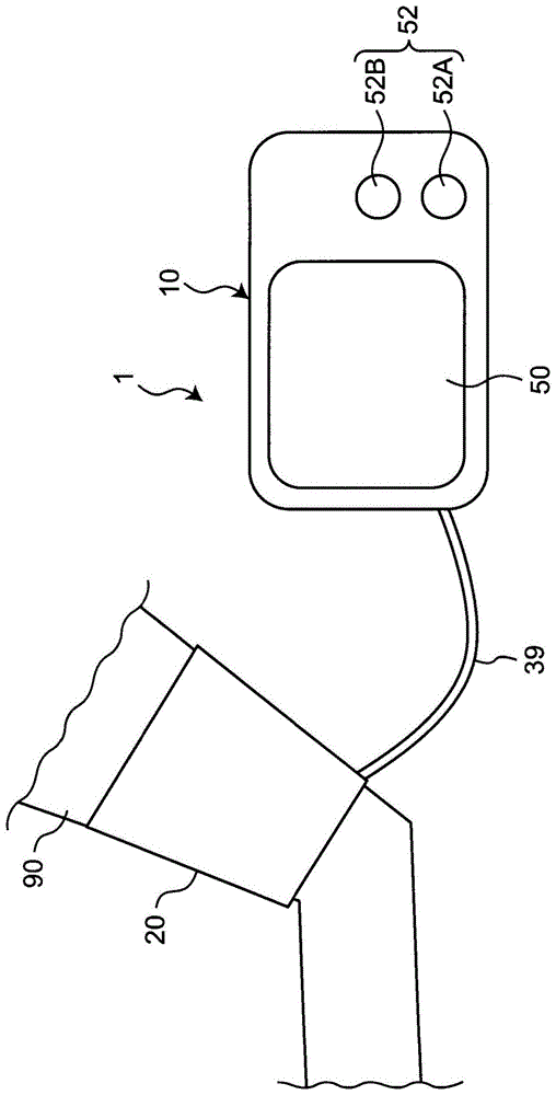 电子血压计以及心力衰竭检测器的制作方法