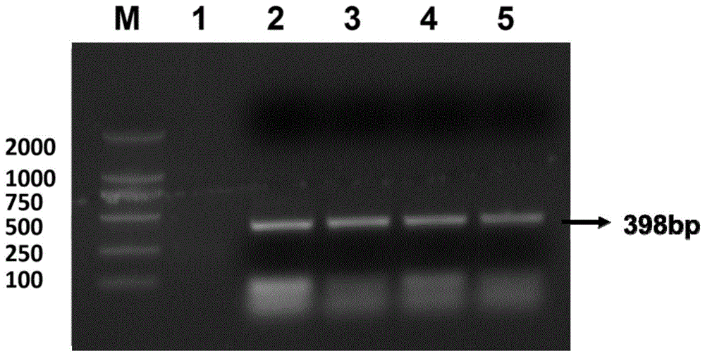 耳念珠菌的实时荧光定量PCR检测试剂盒及其专用引物、TaqMan探针的制作方法