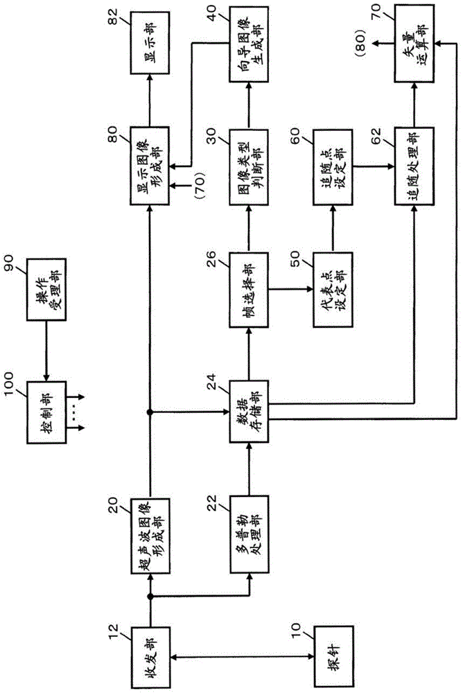 超声波图像处理装置以及程序的制作方法