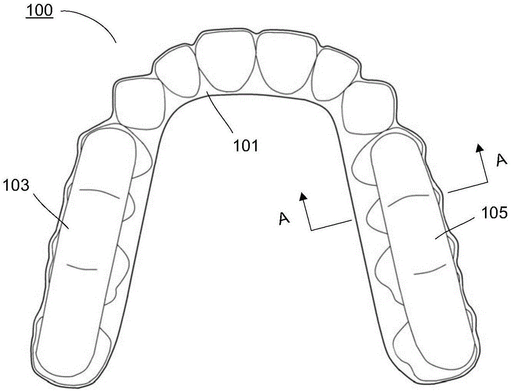 壳状牙科器械及其制作方法与流程