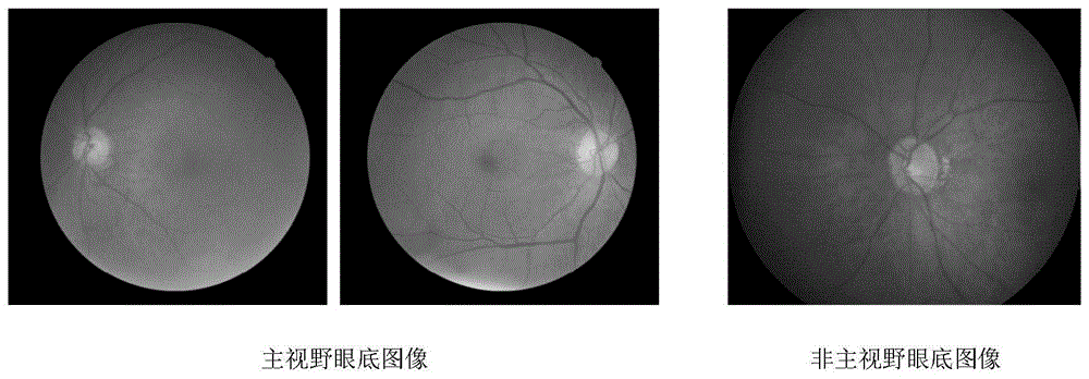 基于深度主动学习的眼底图像左右眼识别方法与流程