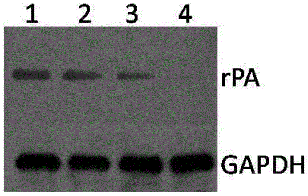 一种表达瑞替普酶rPA的细胞株及方法与流程