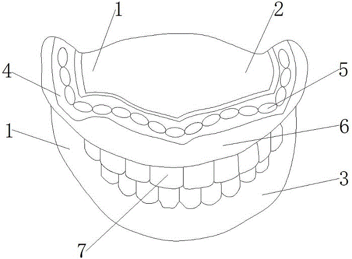 一种钴铬支架可摘全口义齿及加工方法与流程