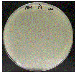 一株鲍曼不动杆菌噬菌体及医用用途的制作方法