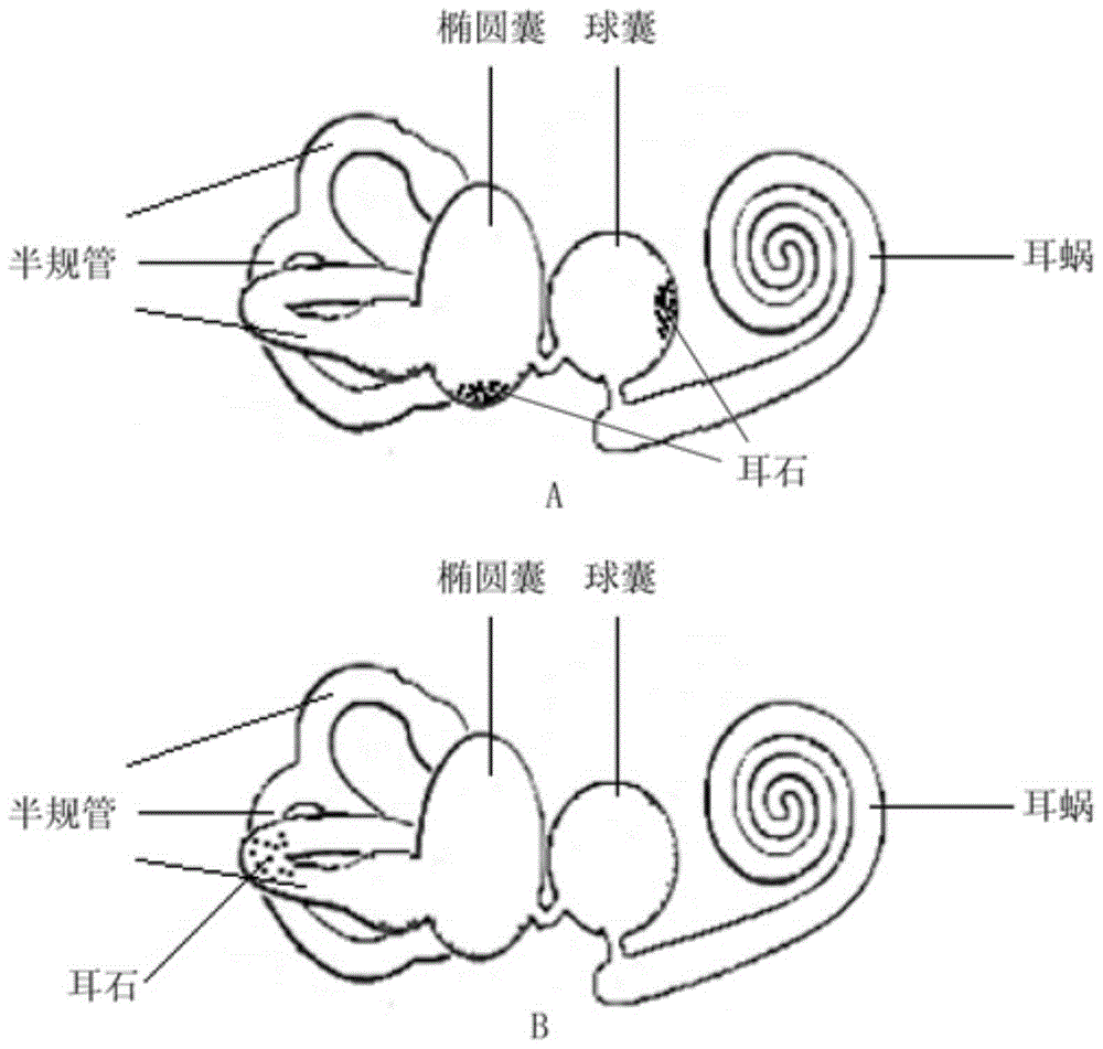 一种内耳平衡器演示教具的制作方法