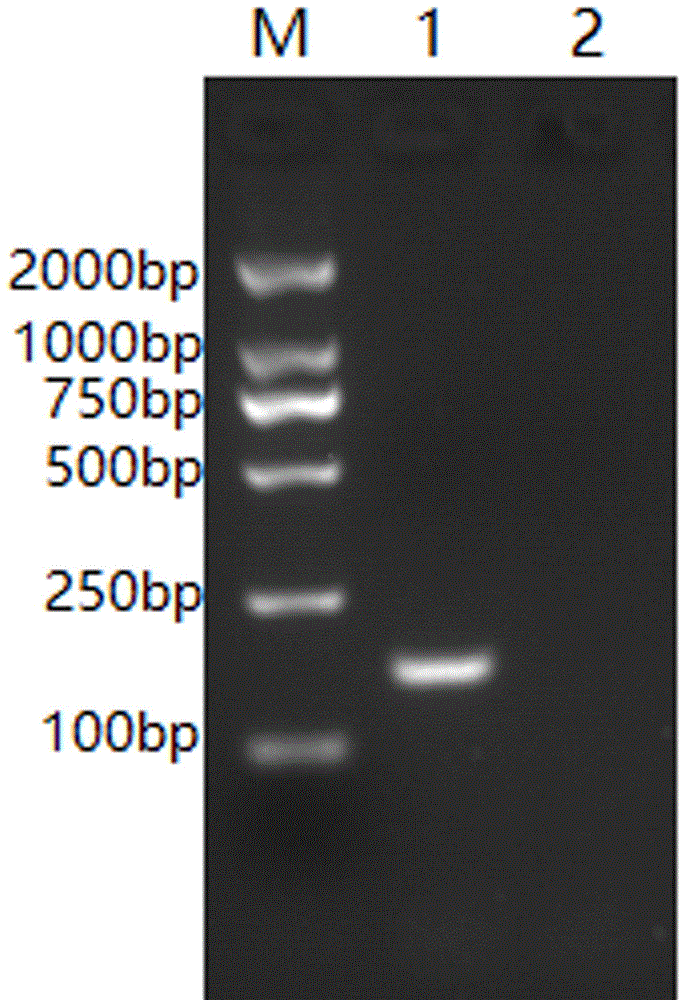 牛诺如病毒的实时荧光定量RT-PCR检测方法与流程