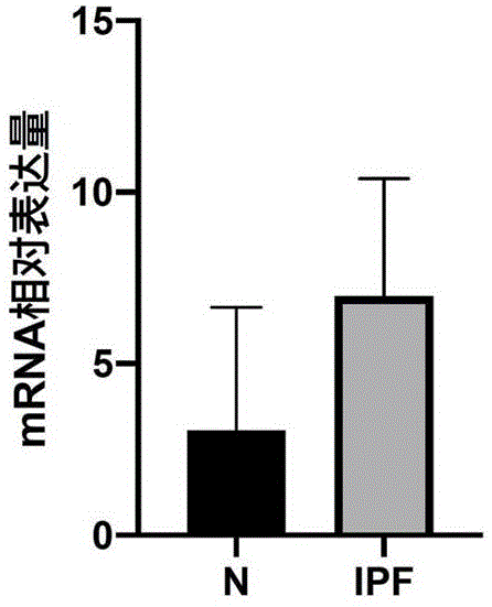 特发性肺纤维化疾病诊断标志物及其制备诊断或预后工具中的应用的制作方法