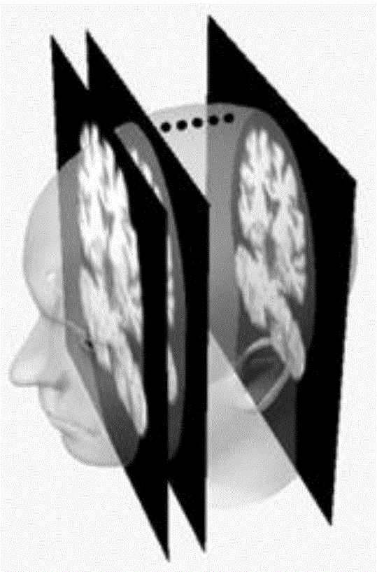 一种利用卷积神经网络的医学图像处理装置与方法与流程
